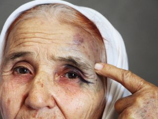 80 yaşındaki kadın eski gelininden dayak yedi