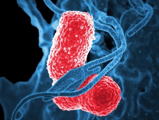 Klebsiella Pneumoniae bakterisinin tedavisi araştırılıyor