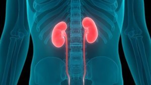 Böbrek taşına zemin hazırlayan alışkanlıklar!