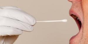 Tükürükten prostat kanseri tespitinde denemelere başlandı