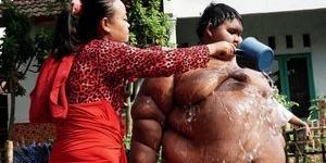 Arya Premana dünyanın en şişman çocuğuydu! Bakın şimdi kaç kilo…