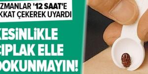 Uzmanlardan kene uyarısı: Kesinlikle çıplak elle dokunmayın.